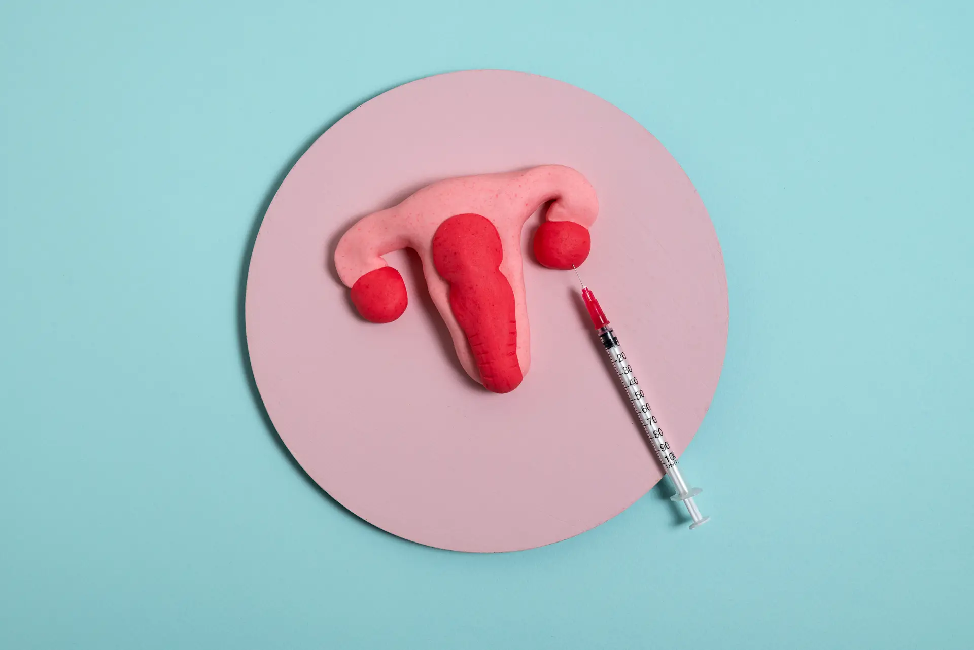 IUI Treatment in Chennai